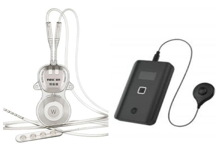 科研动态丨我院成功完成首例脑机接口闭环脑部采集刺激系统（ANS）治疗药物难治性癫痫临床试验项目手术